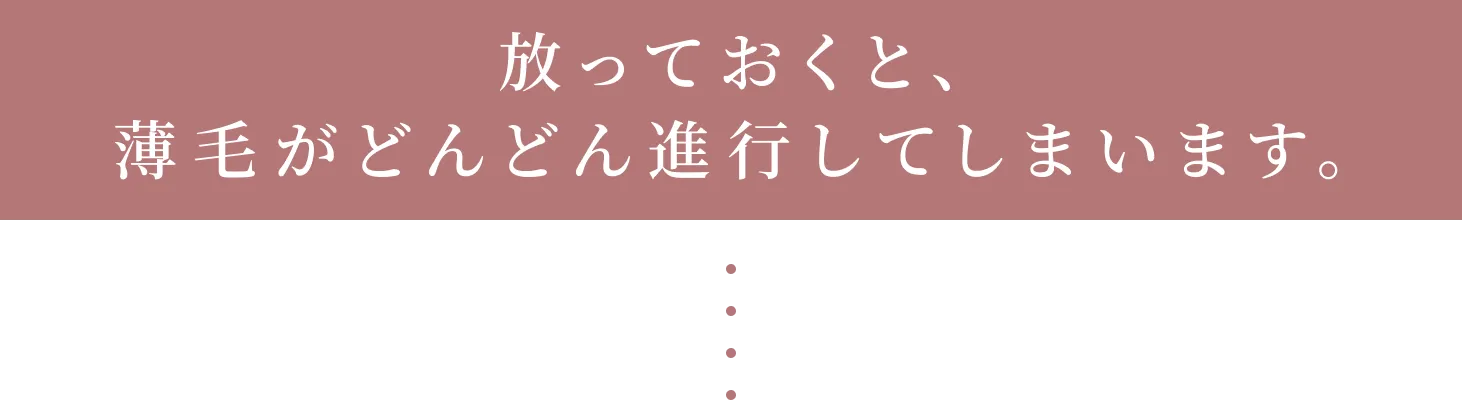 放っておくと、薄毛がどんどん進行してしまいます。