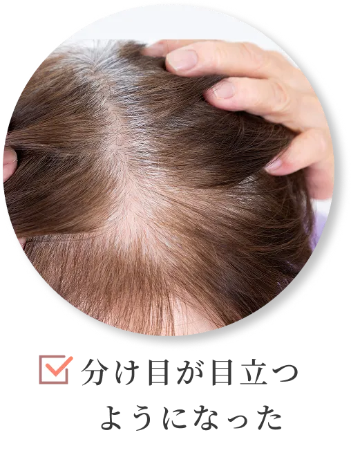 分け目が目立つようになった