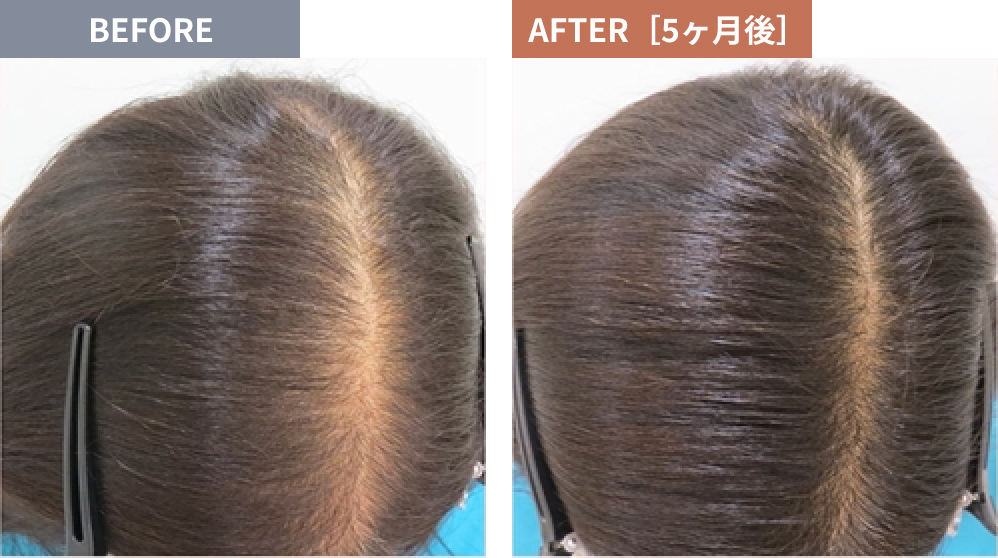 Before After 写真