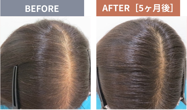 Before After 写真