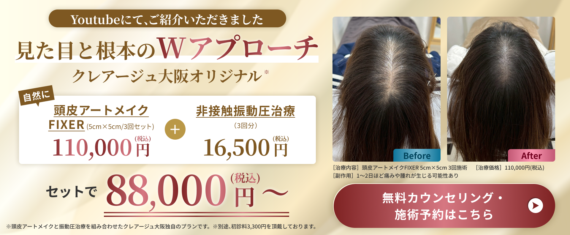Wアプローチプラン セットで88,000円(税込)～ 頭皮アートメイク20%OFF・振動圧治療3回分