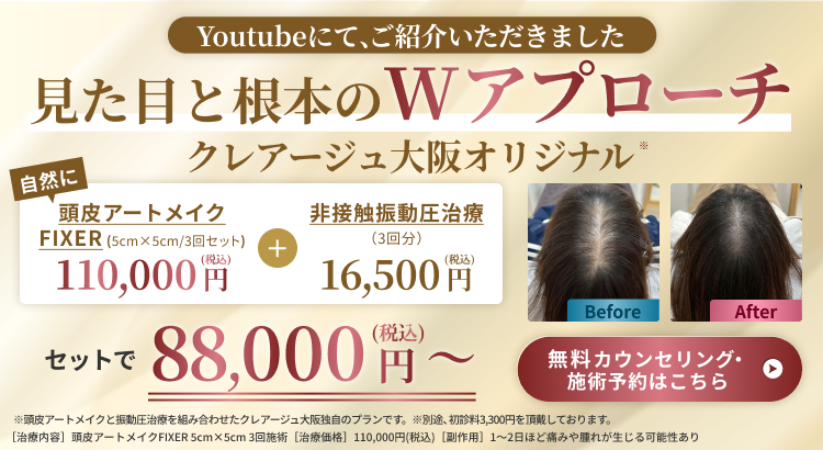 Wアプローチプラン セットで88,000円(税込)～ 頭皮アートメイク20%OFF・振動圧治療3回分