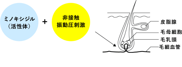 ミノキシジル（活性体）+非接触振動圧刺激の図