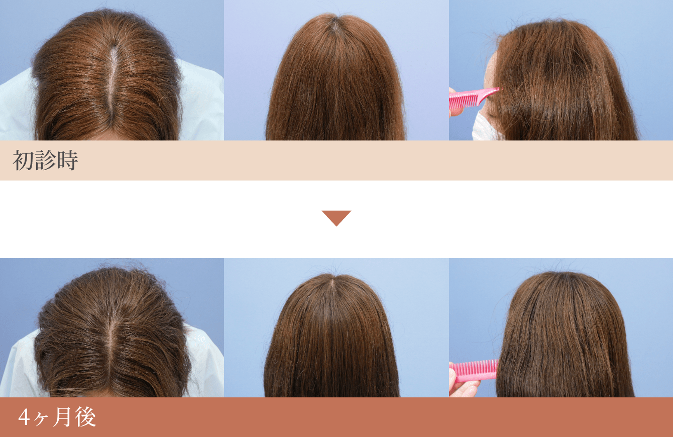美髪治療_症例