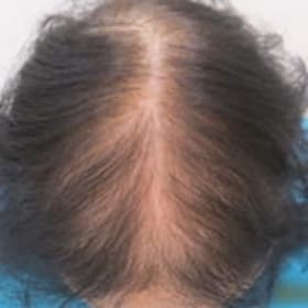 初診時の頭髪