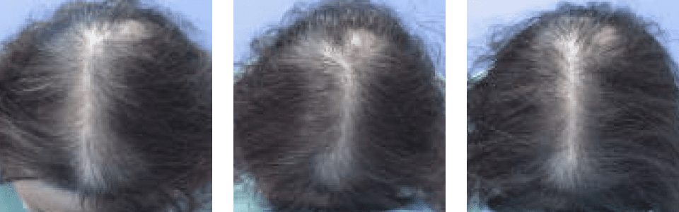 初診時4ヵ月後11ヵ月後