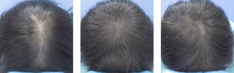 初診時4ヵ月後10ヵ月後