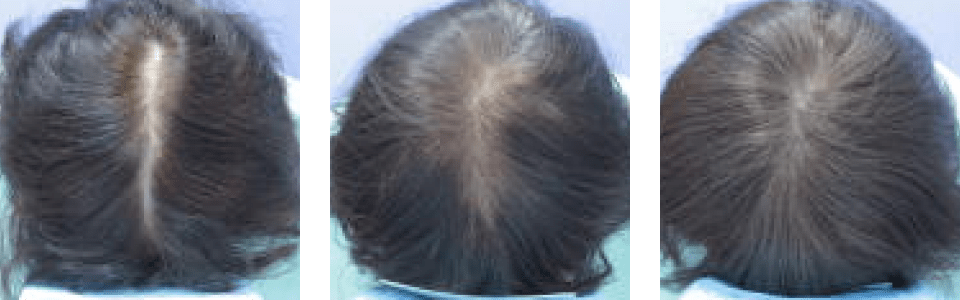 初診時4ヵ月後6ヵ月後