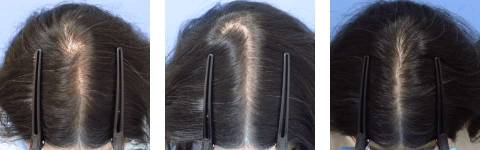 初診時3ヵ月後11ヵ月後