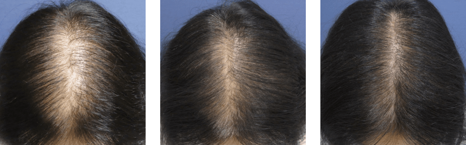 初診時3ヵ月後6ヵ月後