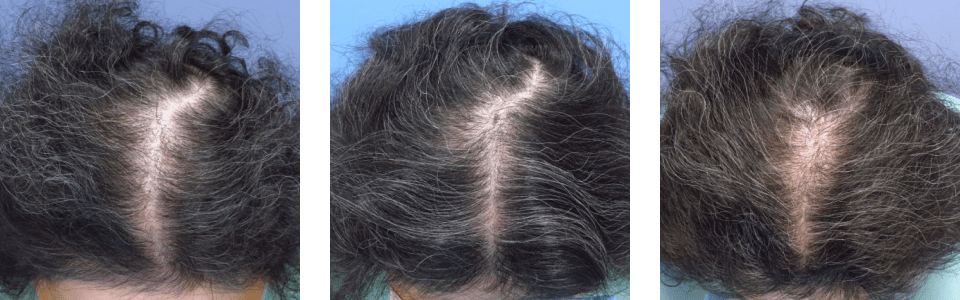 初診時7ヵ月後12ヵ月後