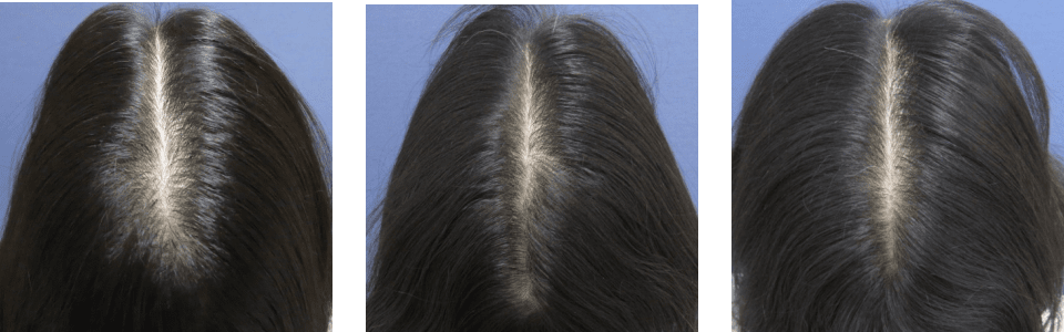 初診時3ヵ月後6ヵ月後