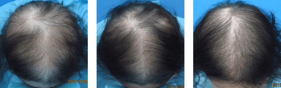 初診時6ヵ月後12ヵ月後