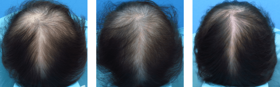 初診時5ヵ月後12ヵ月後