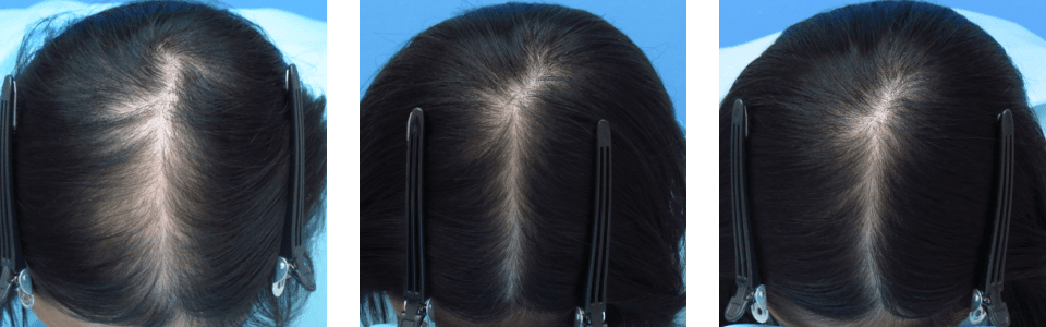 初診時6ヵ月後12ヵ月後