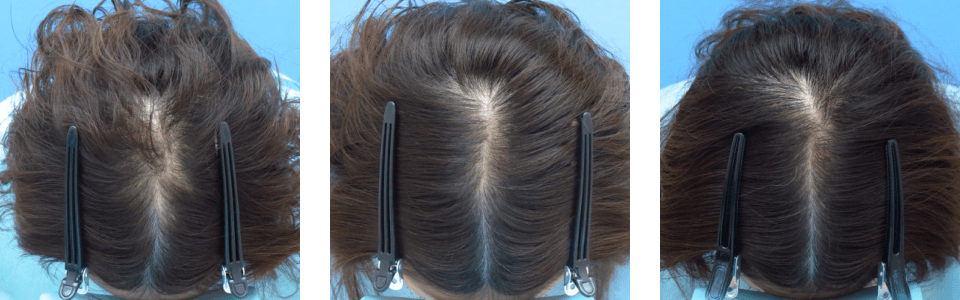 初診時6ヵ月後12ヵ月後