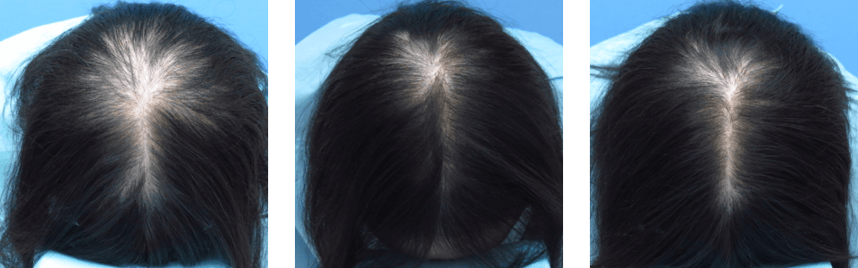 初診時4ヵ月後10ヵ月後