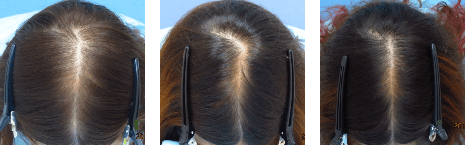 初診時7ヵ月後14ヵ月後