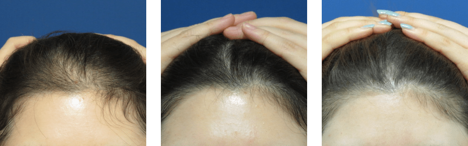 初診時4ヵ月後12ヵ月後