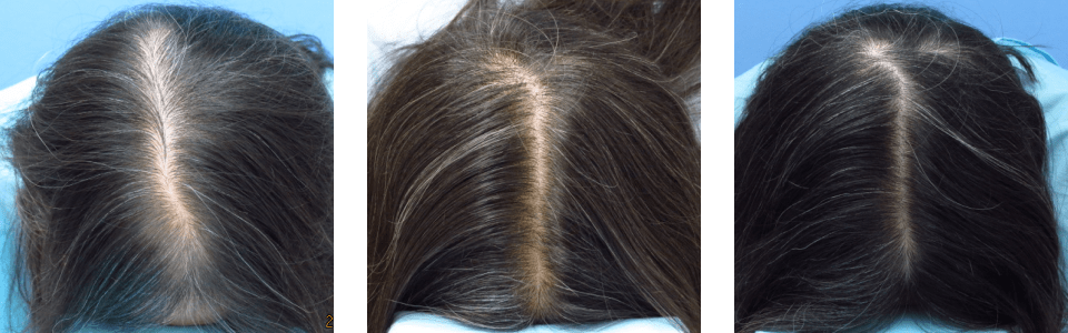 初診時4ヵ月後20ヵ月後