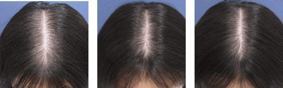 初診時3ヵ月後7ヵ月後