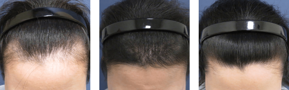 初診時3ヵ月後6ヵ月後