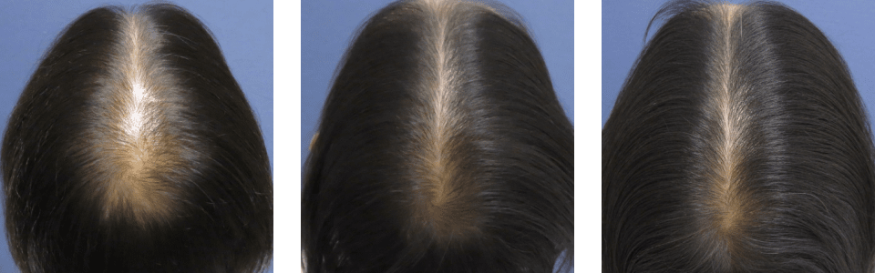 初診時3ヵ月後6ヵ月後