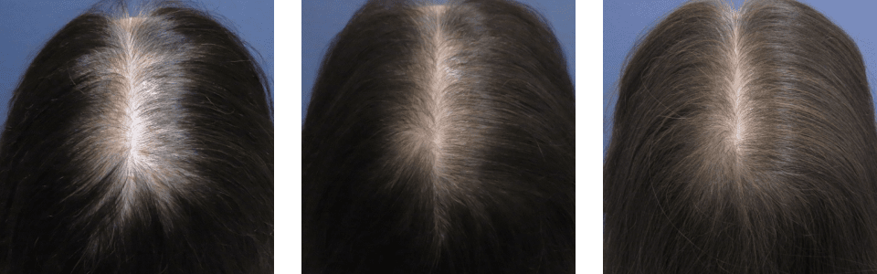 初診時3ヵ月後6ヵ月後