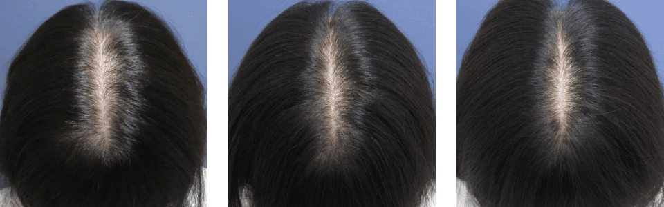 初診時3ヵ月後6ヵ月後