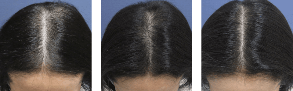 初診時3ヵ月後6ヵ月後