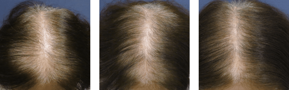 初診時3ヵ月後6ヵ月後