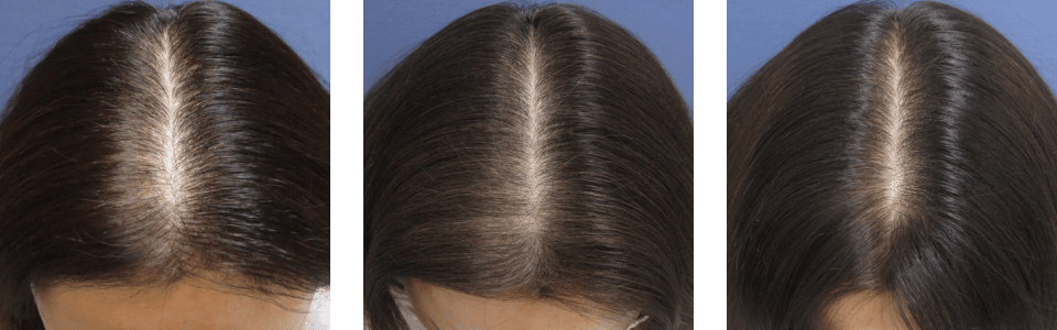 初診時3ヵ月後6ヵ月後