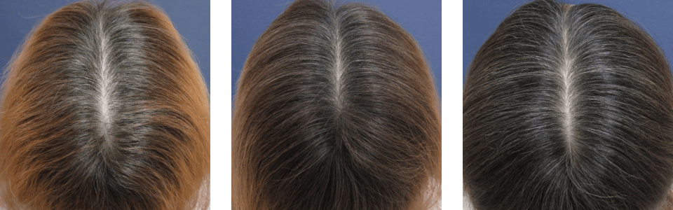 初診時3ヵ月後6ヵ月後