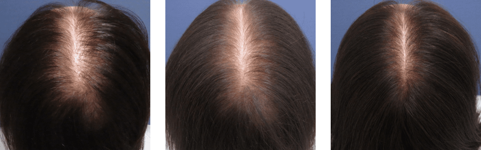 初診時3ヵ月後6ヵ月後