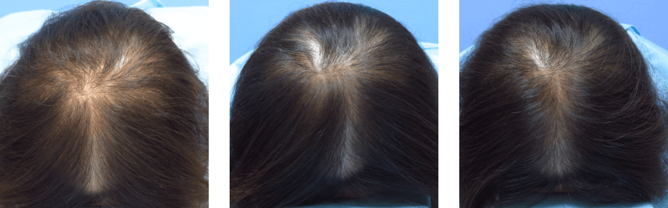 初診時3ヵ月後17ヵ月後