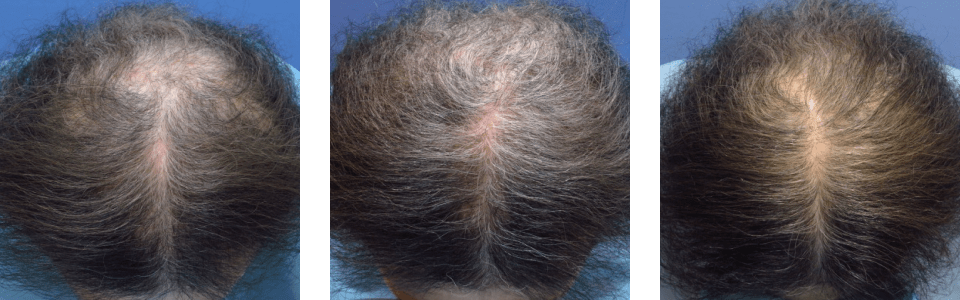 初診時6ヵ月後12ヵ月後