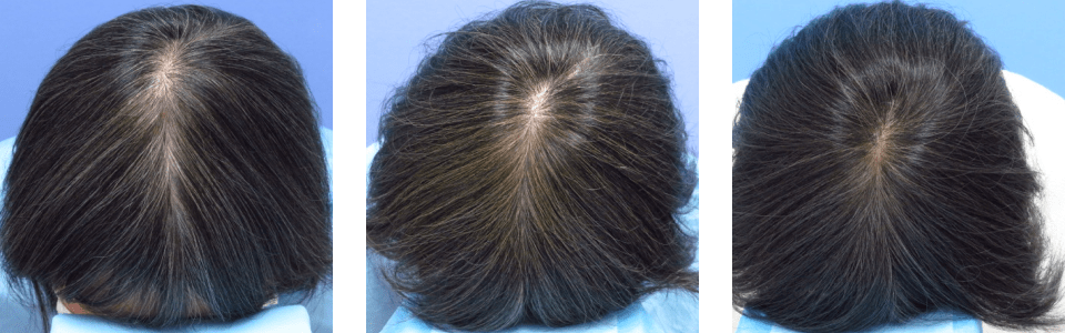 初診時6ヵ月後18ヵ月後