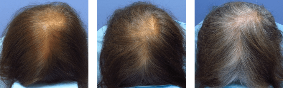 初診時6ヵ月後10ヵ月後