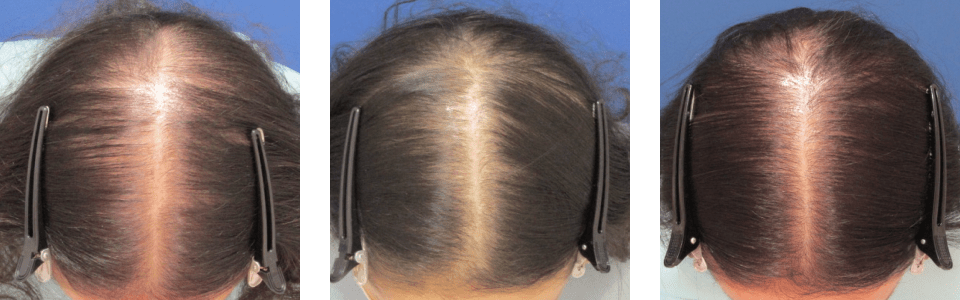 初診時4ヵ月後6ヵ月後