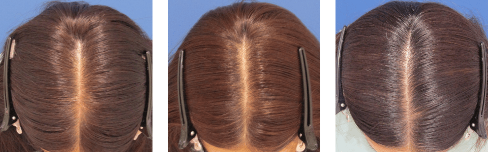 初診時6ヵ月後24ヵ月後