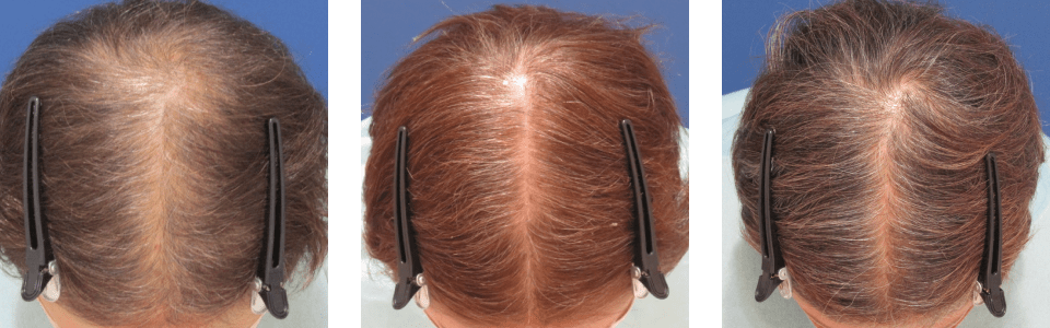 初診時4ヵ月後6ヵ月後