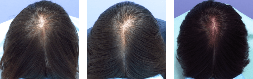 初診時7ヵ月後15ヵ月後