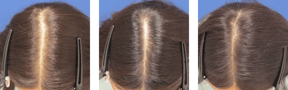 初診時4ヵ月後6ヵ月後