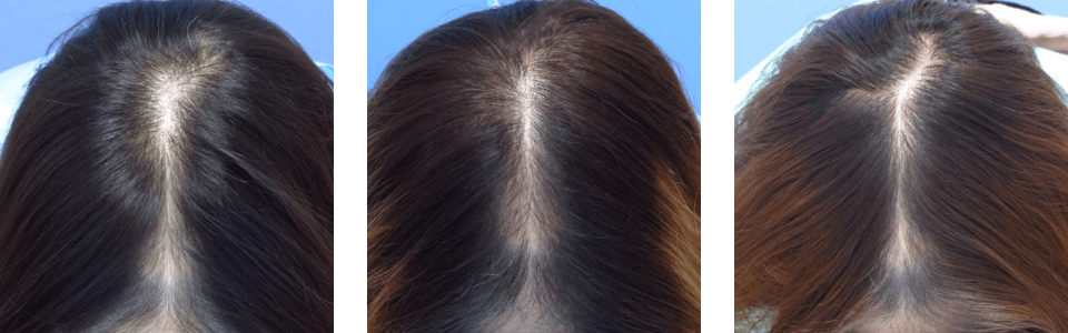 初診時8ヵ月後15ヵ月後