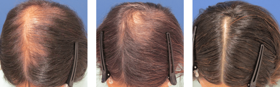 初診時4ヵ月後12ヵ月後