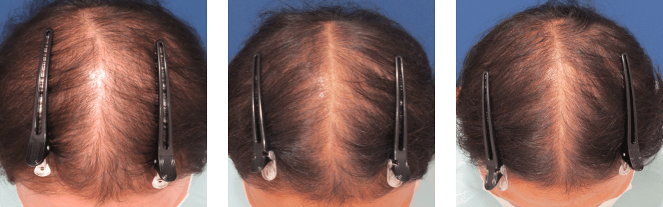 初診時6ヵ月後12ヵ月後