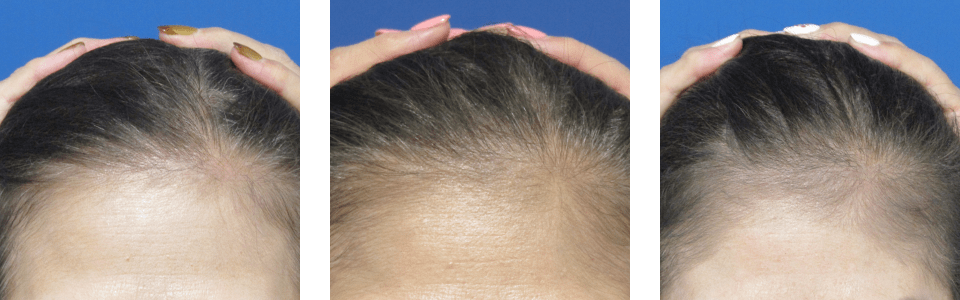 初診時4ヵ月後12ヵ月後