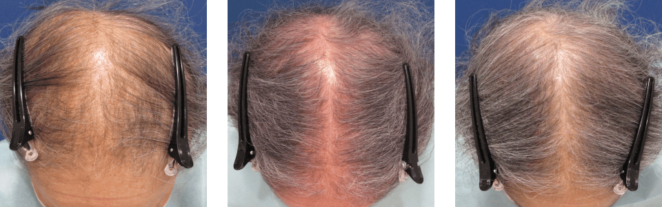 初診時6ヵ月後12ヵ月後