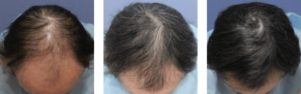 初診時5ヵ月後12ヵ月後