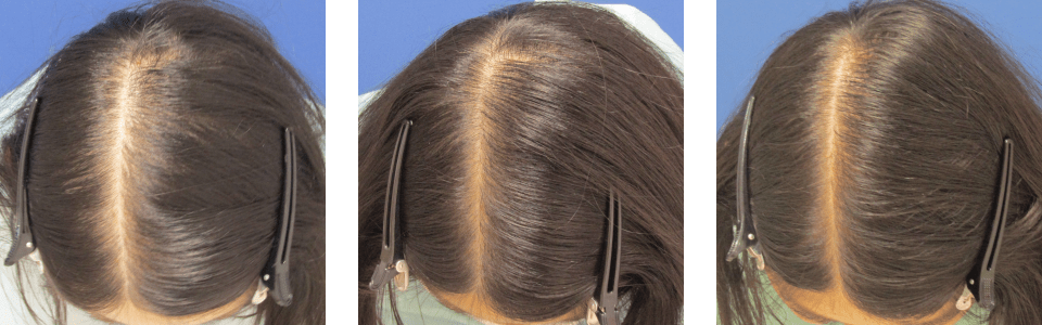 初診時4ヵ月後8ヵ月後